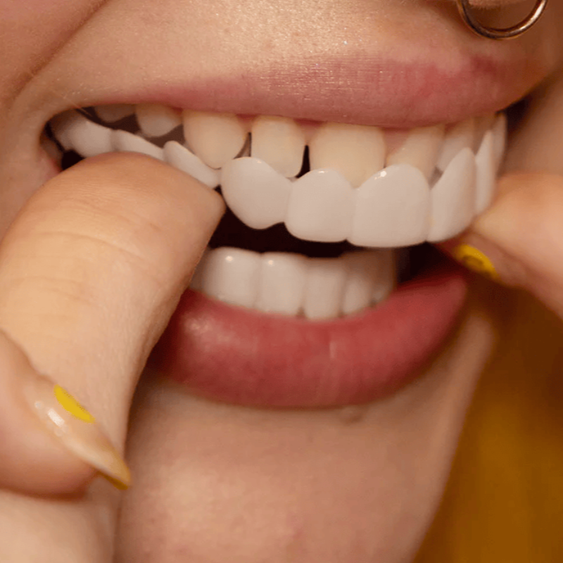 Monde Snap-on Smile Tanden Veneers – Flexibel Kunstgebit voor Boven- en Onderkaak – Herbruikbaar – Natuurlijke Off-White Kleur